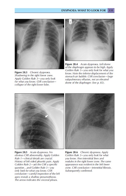 The Chest X-Ray : A Survival Guide - Look Inside - Radiology Courses